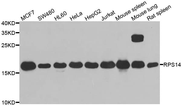 Polyclonal Rabbit anti-Human RPS14 / Ribosomal Protein S14 Antibody (IHC, IF, WB)