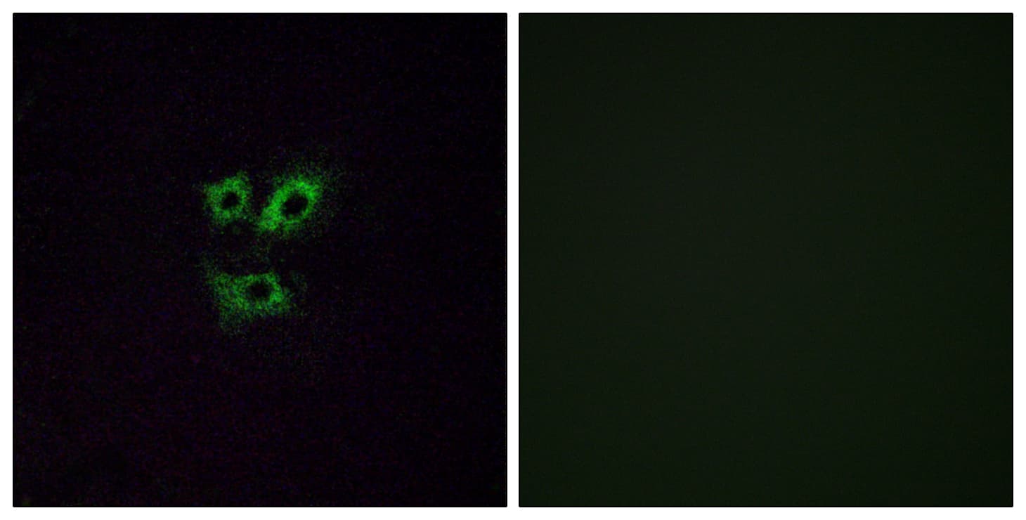 OR2Y1 Antibody (aa161-210)