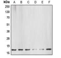 CASP3 / Caspase 3 Antibody (Internal)