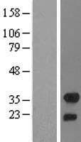 FHL2 Protein (Over-Expression Lysate Myc-DDK (Flag))