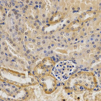 MVK Antibody