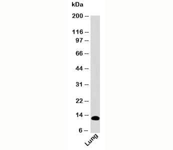 S100A8 / MRP8 Antibody (N-Terminus, clone SA6279)