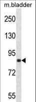 DDR2 Antibody (aa816-843)