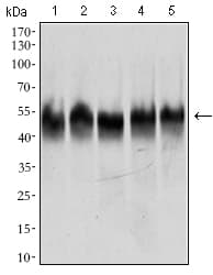 TUBB2A / Tubulin Beta 2A Antibody (aa25-187, clone 6A10B2)