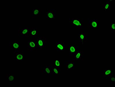 HIST1H2AI Antibody