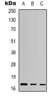 Monoclonal Mouse anti-Human CASP3 / Caspase 3 Antibody (IHC, WB)