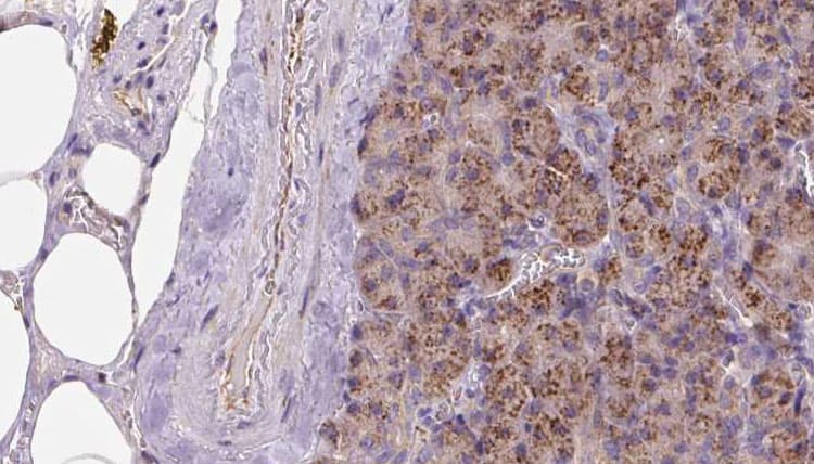 Polyclonal Rabbit anti-Human KIDINS220 / ARMS Antibody (IHC, IF, WB)