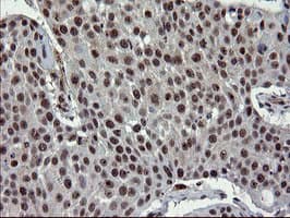 UBE2E3 Antibody (clone OTI1B4)