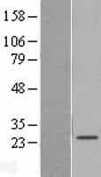 SAMD12 Protein (Over-Expression Lysate Myc-DDK (Flag))