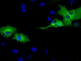 AK5 / Adenylate Kinase 5 Antibody (clone OTI2A6)
