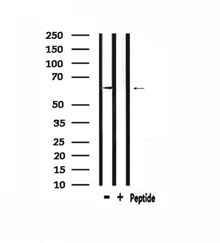CaMKII Alpha+Beta+Delta Antibody (aa516-542)