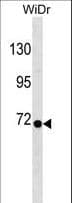 Polyclonal Rabbit anti-Human RPN1 / Ribophorin I Antibody (aa559-587, WB)