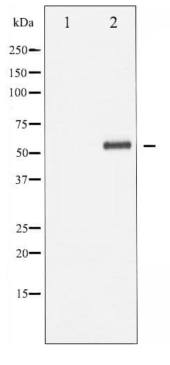 DOK1 Antibody (phospho-Tyr362)