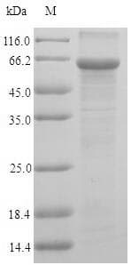 Human UAP1 Protein (Recombinant 6His, N-terminus)