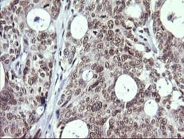 MAP2K1 / MKK1 / MEK1 Antibody (clone OTI2F1)
