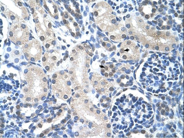 Loricrin Antibody (aa58-107, HRP)