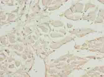CAP2 Antibody