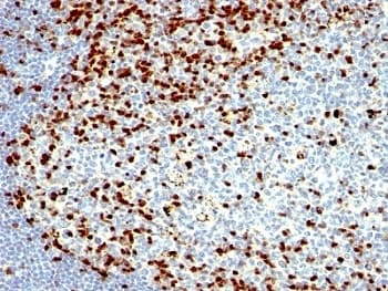 Monoclonal Mouse anti-Human ZAP70 Antibody (clone SPM362, IHC, IF)