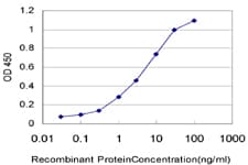 IHC-plus™ HNRPM / HNRNPM Antibody (clone 3F7)
