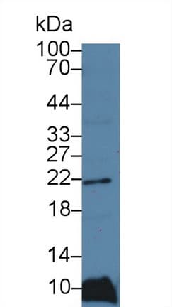 FTL / Ferritin Light Chain Antibody (Biotin)