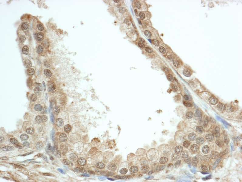 Polyclonal Rabbit anti-Human FKBP4 / FKBP52 Antibody (aa400-440, IHC, WB)