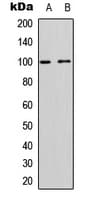 NEP / DDR1 Antibody (C-Terminus)