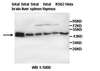 Polyclonal Rabbit anti-Human TUBB3 / Tubulin Beta 3 Antibody (IHC, WB)