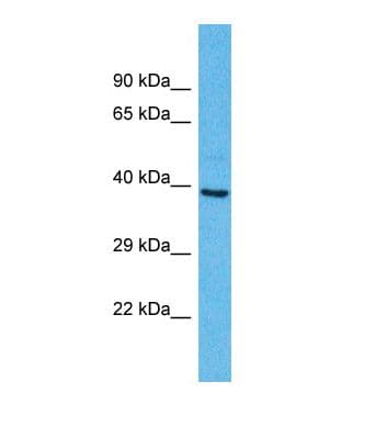 OR2A25 Antibody (C-Terminus)