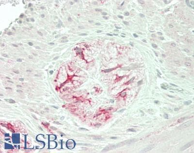 IHC-plus™ VTI1A Antibody (aa21-70)