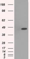 Monoclonal Mouse anti-Human MAPK12 / ERK6 / SAPK3 Antibody (clone OTI10E1, IHC, WB)