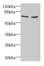 IHC-plus™ TNFRSF11A / RANK Antibody