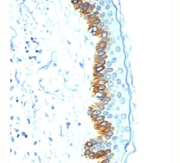 Acidic Cytokeratin AE1 Antibody (clone AE1, Ready-to-Use)