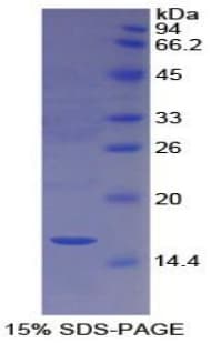 Mouse CUBN / Cubilin Protein (Recombinant His)