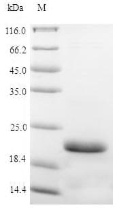 Pig AVPR2 / V2R Protein (Recombinant 6His-SUMO, N-terminus)