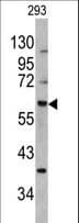 MDM2 Antibody (Ser166)