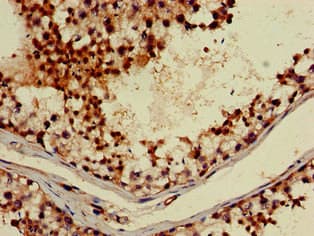 ABI2B / ABI2 Antibody