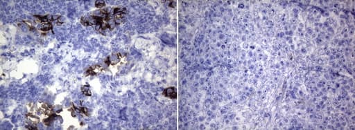 ROS1 / ROS Antibody (aa2126-2347, clone OTI7E4, Carrier-free)