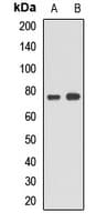 ACS5 / ACSL5 Antibody