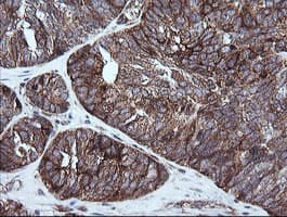 Monoclonal Mouse anti-Human RIOK2 Antibody (clone OTI3E11, IHC, IF, WB)