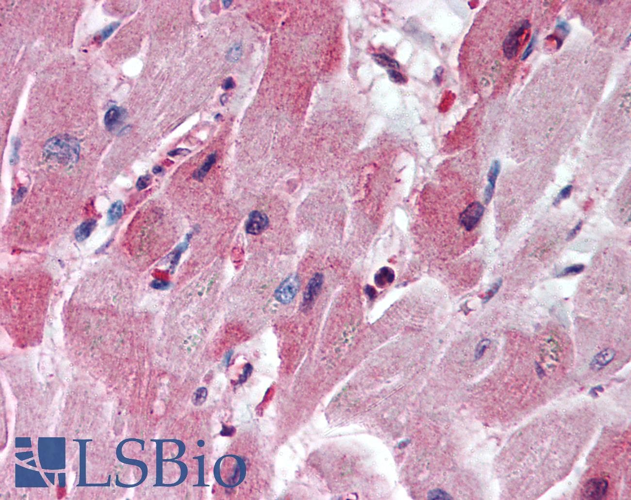 IHC-plus™ Polyclonal Rabbit anti-Rat HTR3A / 5-HT3A Receptor Antibody (aa21-36, IHC, WB)
