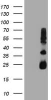 TIMP2 Antibody (clone OTI3H8)