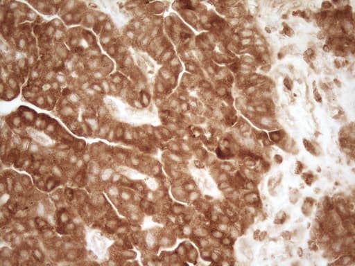 GRN / Granulin Antibody (aa327-593, clone OTI2F4)