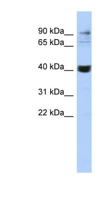 Polyclonal Rabbit anti-Human MMP3 Antibody (C-Terminus, WB)