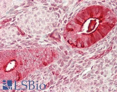 IHC-plus™ MUC16 / CA125 Antibody (aa 21712-21973)