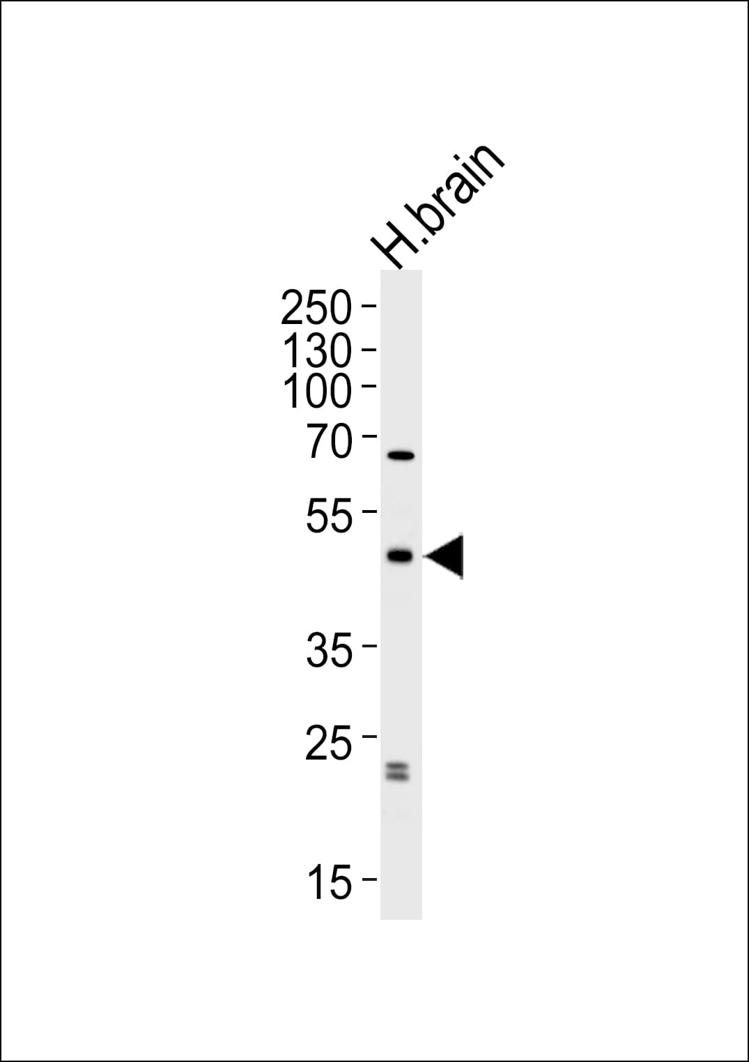ABHD12 Antibody (aa40-66)