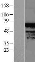 TIGD4 Protein (Over-Expression Lysate Myc-DDK (Flag))
