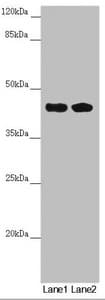 CEP44 / KIAA1712 Antibody