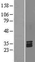STC1 / Stanniocalcin Protein (Over-Expression Lysate Myc-DDK (Flag))
