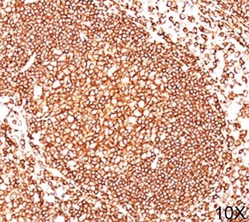 CD45 / LCA Antibody (clone 2B11 + PD7/26, Ready-to-Use)