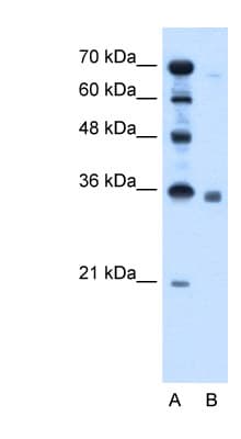SGPP2 Antibody (aa301-350)